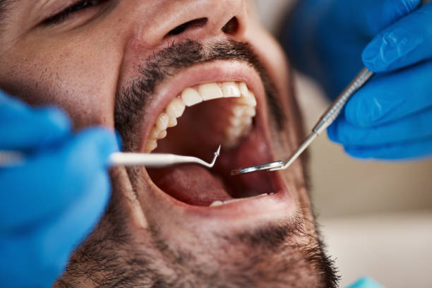 Best Pediatric Emergency Dentist in South Gate Ridge, FL